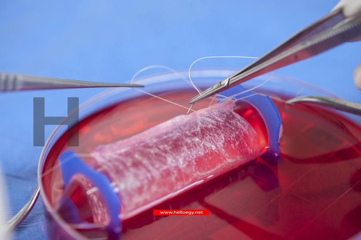 BBC : Doctors implant lab-grown vagina